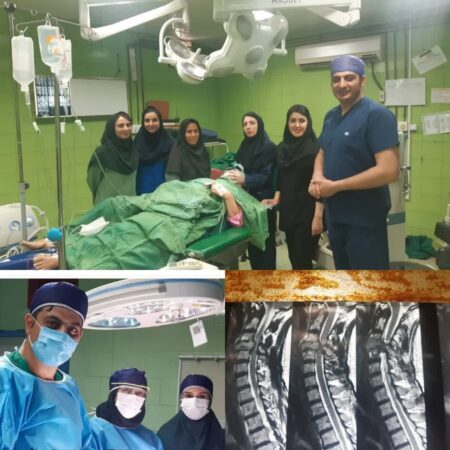 انجام جراحی پیچیده مهره گردن برای نخستین بار در پارس آبادمغان